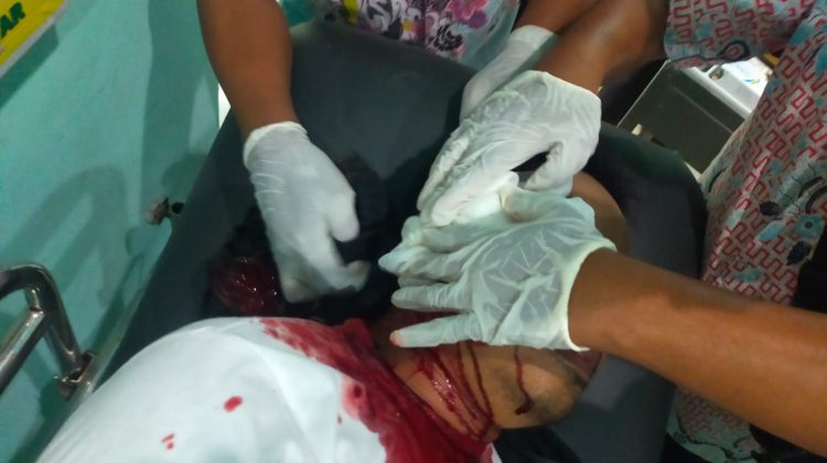 Ketua P2KD korban pembacokan di Jalan Raya Pakong.

Foto : Anam Klikku Dok.